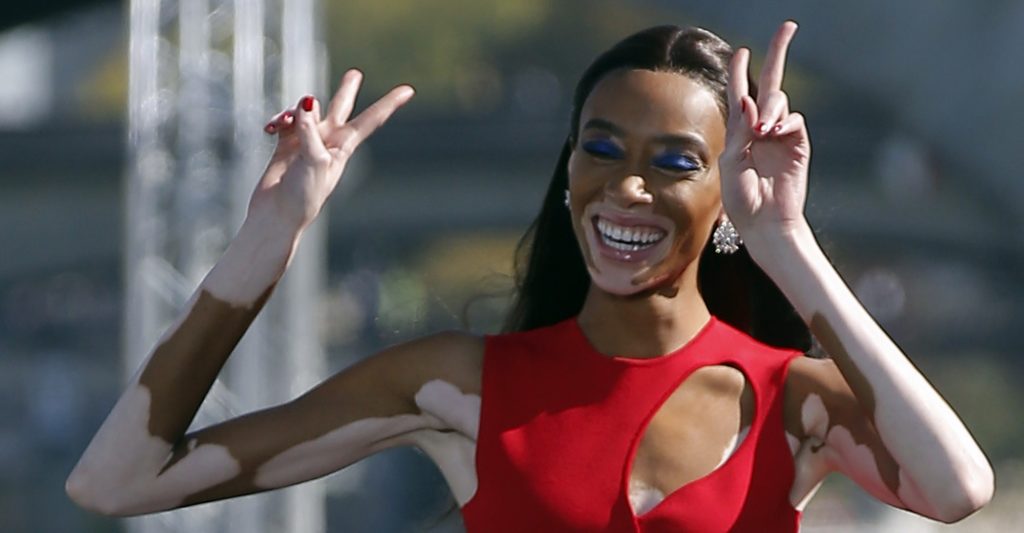 Model Winnie Harlow models during L'Oreal show part of Spring/Summer 2019 ready-to-wear fashion week presented in Paris, Sunday, Sept.30, 2018. (AP Photo/Michel Euler)